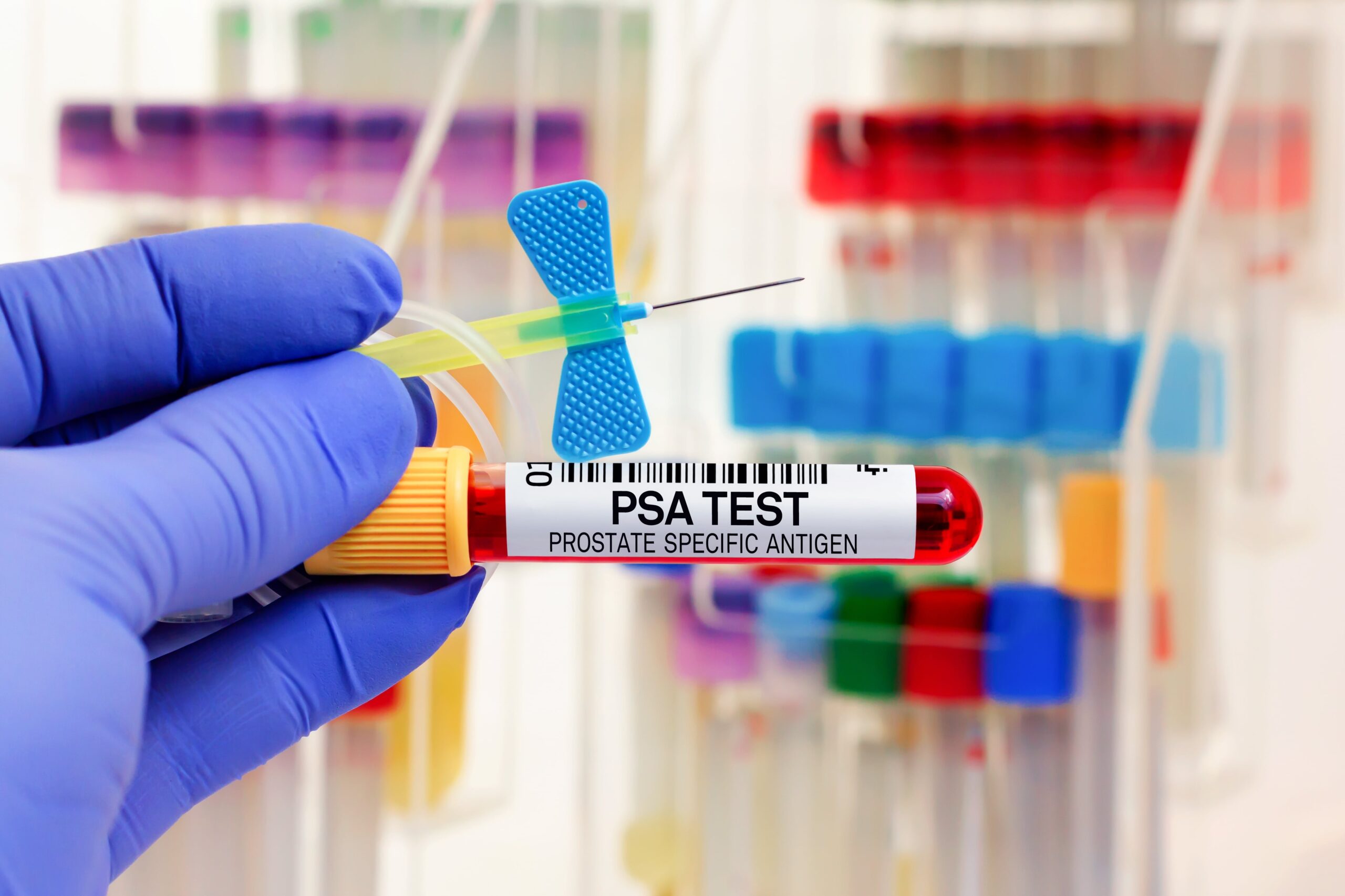 hand with a glove holding niddle and blood container labeled PSA test.