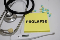 pelvic organ prolapse